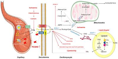 PCSK9 in Myocardial Infarction and Cardioprotection: Importance of Lipid Metabolism and Inflammation